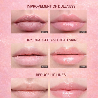 Vitarise Lip Peptides Balms