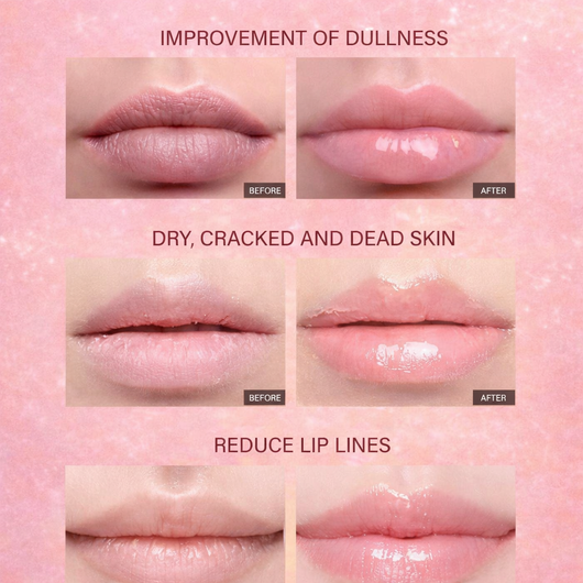 Vitarise Lip Peptides Balms