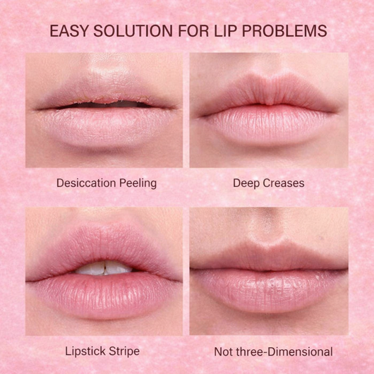 Vitarise Lip Peptides Balms